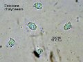 Entoloma chalybaeum-amf1987-micro